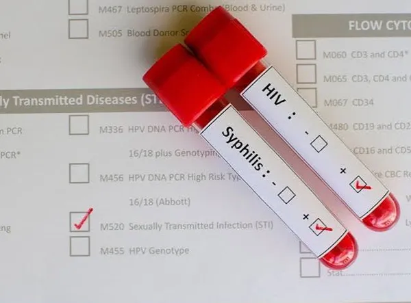 std check