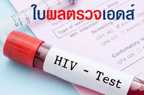ตรวจเอดส์